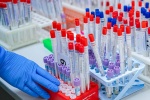 В Москве экспресс-тесты на антитела к коронавирусу сдали 50 тыс медиков